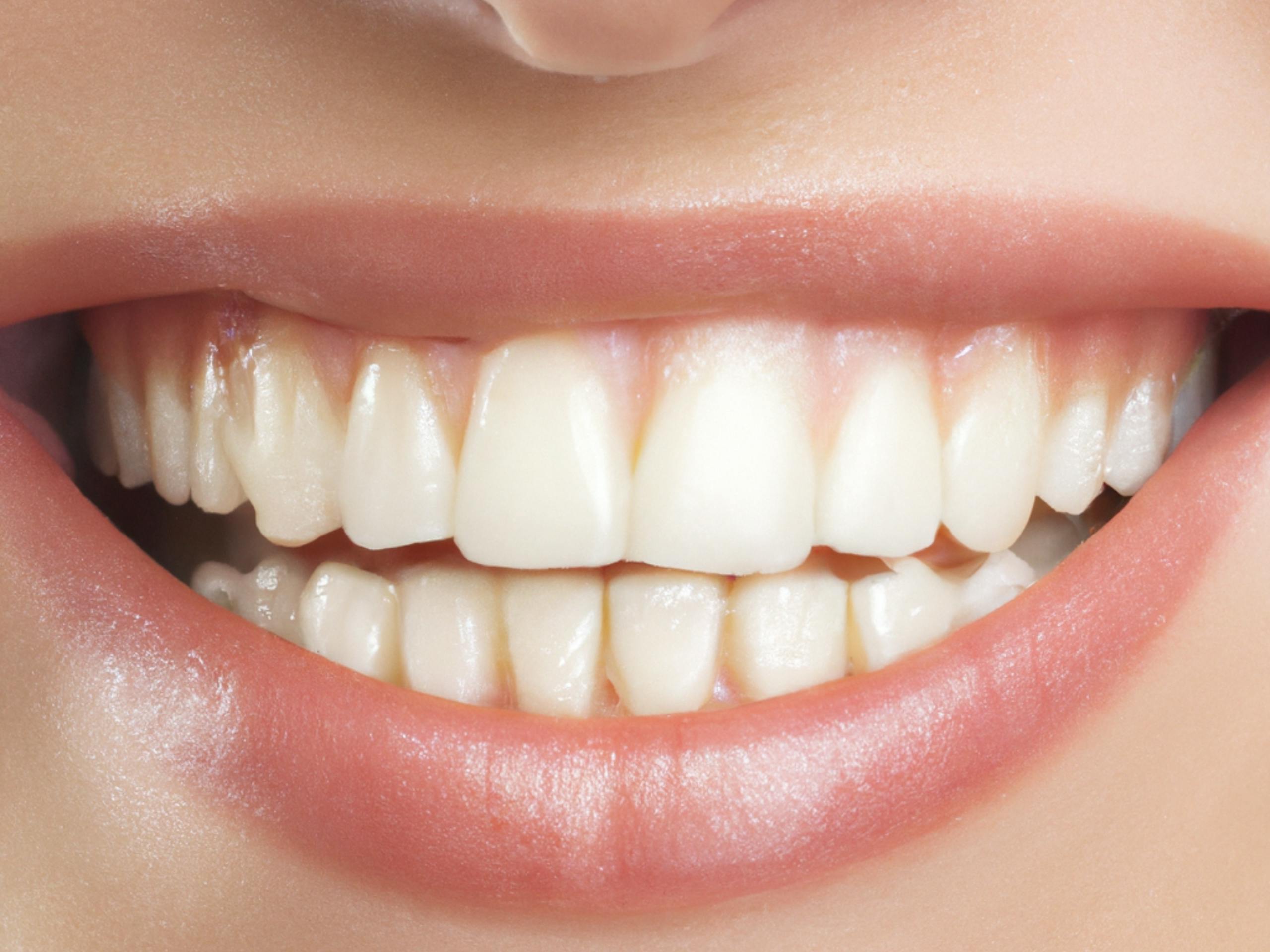 reverse engineering goals clean healthy teeth goal setting framework